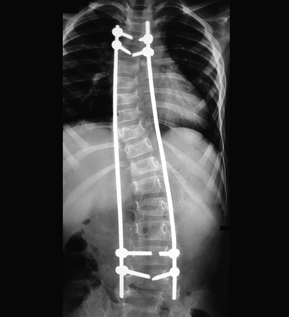 Post-Op