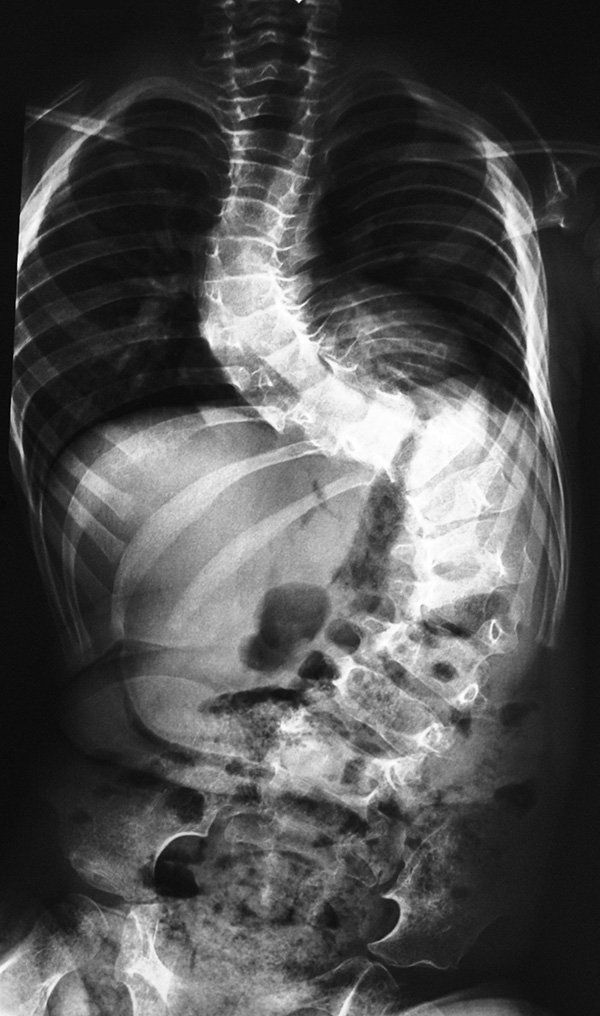 Pre-Op